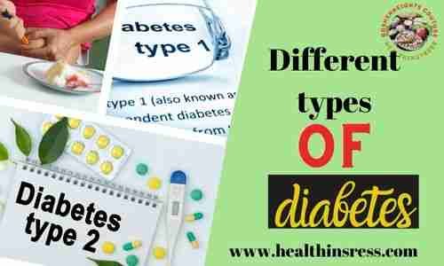 managing diabetes expecially the different types